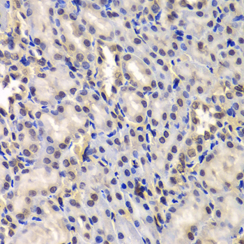 DDX41 / ABS Antibody - Immunohistochemistry of paraffin-embedded rat kidney tissue.