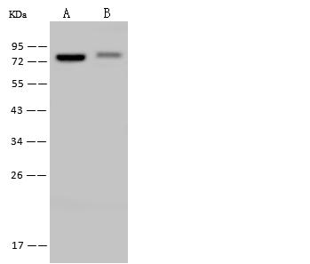 DDX41 / ABS Antibody - Anti-DDX41 rabbit polyclonal antibody at 1:500 dilution. Lane A: Jurkat Whole Cell Lysate. Lane B: H1299 Whole Cell Lysate. Lysates/proteins at 30 ug per lane. Secondary: Goat Anti-Rabbit IgG (H+L)/HRP at 1/10000 dilution. Developed using the ECL technique. Performed under reducing conditions. Predicted band size: 70 kDa. Observed band size: 75 kDa.