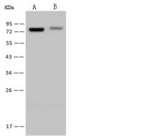 DDX41 / ABS Antibody - Anti-DDX41 rabbit polyclonal antibody at 1:500 dilution. Lane A: Jurkat Whole Cell Lysate. Lane B: H1299 Whole Cell Lysate. Lysates/proteins at 30 ug per lane. Secondary: Goat Anti-Rabbit IgG (H+L)/HRP at 1/10000 dilution. Developed using the ECL technique. Performed under reducing conditions. Predicted band size: 70 kDa. Observed band size: 75 kDa.