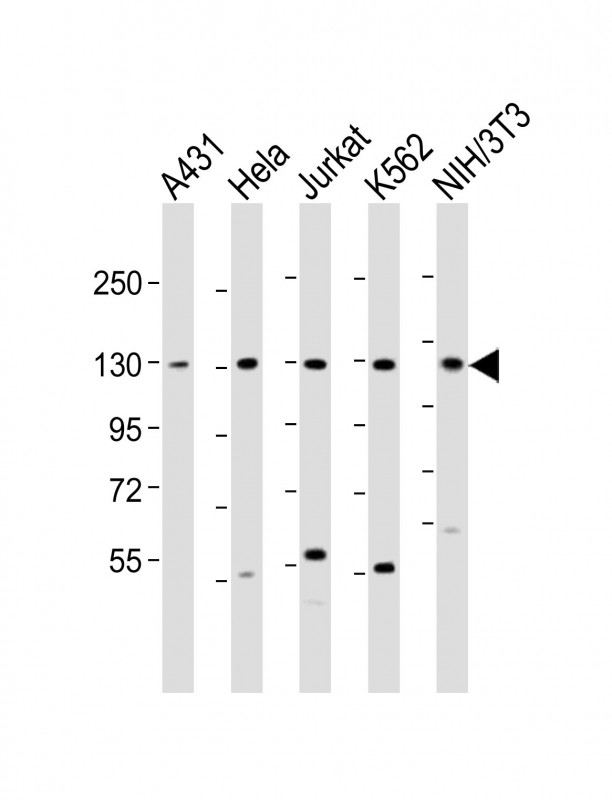 DDX42 Antibody - All lanes: Anti-DDX42 Antibody (N-Term) at 1:2000 dilution. Lane 1: A431 whole cell lysate. Lane 2: HeLa whole cell lysate. Lane 3: Jurkat whole cell lysate. Lane 4: K562 whole cell lysate. Lane 5: NIH/3T3 whole cell lysate Lysates/proteins at 20 ug per lane. Secondary Goat Anti-Rabbit IgG, (H+L), Peroxidase conjugated at 1:10000 dilution. Predicted band size: 103 kDa. Blocking/Dilution buffer: 5% NFDM/TBST.