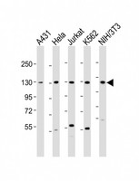 DDX42 Antibody - All lanes: Anti-DDX42 Antibody (N-Term) at 1:2000 dilution. Lane 1: A431 whole cell lysate. Lane 2: HeLa whole cell lysate. Lane 3: Jurkat whole cell lysate. Lane 4: K562 whole cell lysate. Lane 5: NIH/3T3 whole cell lysate Lysates/proteins at 20 ug per lane. Secondary Goat Anti-Rabbit IgG, (H+L), Peroxidase conjugated at 1:10000 dilution. Predicted band size: 103 kDa. Blocking/Dilution buffer: 5% NFDM/TBST.