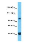 DDX42 Antibody - Western blot of DDX42 Antibody with human MCF7 Whole Cell lysate.  This image was taken for the unconjugated form of this product. Other forms have not been tested.