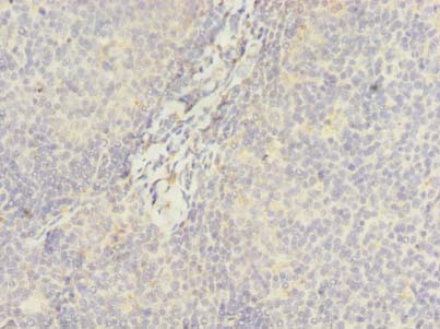 DDX42 Antibody - Immunohistochemistry of paraffin-embedded human tonsil using antibody at dilution of 1:100.