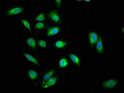 DDX42 Antibody - Immunofluorescence staining of Hela cells with DDX42 Antibody at 1:200, counter-stained with DAPI. The cells were fixed in 4% formaldehyde, permeabilized using 0.2% Triton X-100 and blocked in 10% normal Goat Serum. The cells were then incubated with the antibody overnight at 4°C. The secondary antibody was Alexa Fluor 488-congugated AffiniPure Goat Anti-Rabbit IgG(H+L).