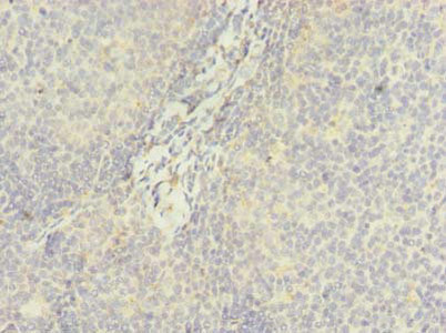 DDX42 Antibody - Immunohistochemistry of paraffin-embedded human tonsil tissue using DDX42 Antibody at dilution of 1:100