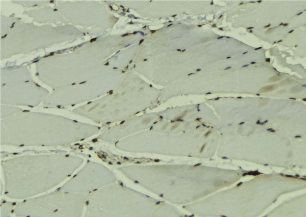 DDX42 Antibody - 1:100 staining mouse muscle tissue by IHC-P. The sample was formaldehyde fixed and a heat mediated antigen retrieval step in citrate buffer was performed. The sample was then blocked and incubated with the antibody for 1.5 hours at 22°C. An HRP conjugated goat anti-rabbit antibody was used as the secondary.