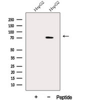 DDX43 Antibody - Western blot analysis of extracts of HepG2 cells using DDX43 antibody. The lane on the left was treated with blocking peptide.