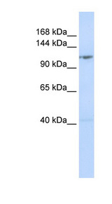 DDX46 Antibody - DDX46 antibody Western blot of MCF7 cell lysate. This image was taken for the unconjugated form of this product. Other forms have not been tested.