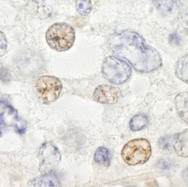 DDX46 Antibody - Detection of Mouse DDX46 by Immunohistochemistry. Sample: FFPE section of mouse teratoma. Antibody: Affinity purified rabbit anti-DDX46 used at a dilution of 1:250.