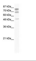 DDX46 Antibody - Jurkat Cell Lysate.  This image was taken for the unconjugated form of this product. Other forms have not been tested.