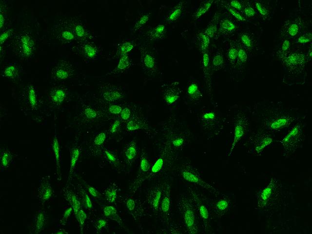 DDX46 Antibody - Immunofluorescence staining of DDX46 in U251MG cells. Cells were fixed with 4% PFA, permeabilzed with 0.1% Triton X-100 in PBS, blocked with 10% serum, and incubated with rabbit anti-Human DDX46 polyclonal antibody (dilution ratio 1:200) at 4°C overnight. Then cells were stained with the Alexa Fluor 488-conjugated Goat Anti-rabbit IgG secondary antibody (green). Positive staining was localized to Nucleus.