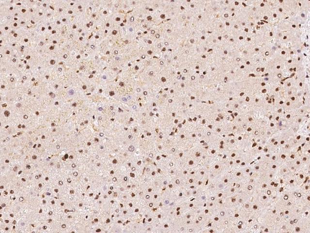 DDX46 Antibody - Immunochemical staining of human DDX46 in human liver with rabbit polyclonal antibody at 1:100 dilution, formalin-fixed paraffin embedded sections.