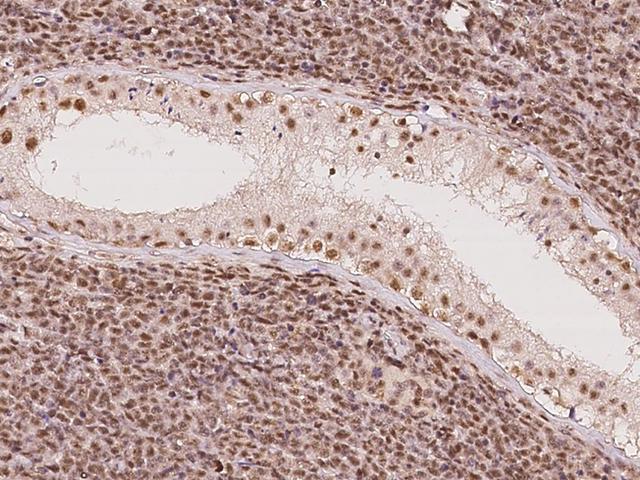 DDX46 Antibody - Immunochemical staining of human DDX46 in human testis with rabbit polyclonal antibody at 1:100 dilution, formalin-fixed paraffin embedded sections.