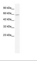 DDX47 Antibody - Jurkat Cell Lysate.  This image was taken for the unconjugated form of this product. Other forms have not been tested.
