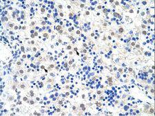 DDX47 Antibody - DDX47 antibody ARP41210_T100-NP_057439-DDX47 (DEAD (Asp-Glu-Ala-Asp) box polypeptide 47) Antibody was used in IHC to stain formalin-fixed, paraffin-embedded human liver.  This image was taken for the unconjugated form of this product. Other forms have not been tested.