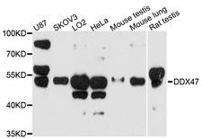 DDX47 Antibody - Western blot analysis of extracts of various cell lines, using DDX47 antibody at 1:1000 dilution. The secondary antibody used was an HRP Goat Anti-Rabbit IgG (H+L) at 1:10000 dilution. Lysates were loaded 25ug per lane and 3% nonfat dry milk in TBST was used for blocking. An ECL Kit was used for detection and the exposure time was 90s.