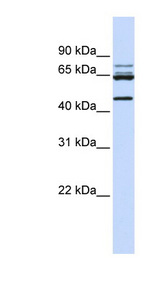DDX47 Antibody - DDX47 antibody Western blot of MCF7 cell lysate. This image was taken for the unconjugated form of this product. Other forms have not been tested.