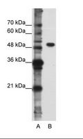 DDX47 Antibody - A: Marker, B: Jurkat Cell Lysate.  This image was taken for the unconjugated form of this product. Other forms have not been tested.