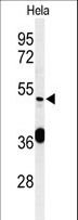 DDX49 Antibody - Western blot of DDX49 Antibody in HeLa cell line lysates (35 ug/lane). DDX49 (arrow) was detected using the purified antibody.