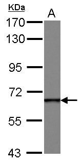 DDX49 Antibody - Sample (30 ug of whole cell lysate) A: HeLa 7.5% SDS PAGE DDX49 antibody diluted at 1:1000