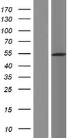 DDX49 Protein - Western validation with an anti-DDK antibody * L: Control HEK293 lysate R: Over-expression lysate