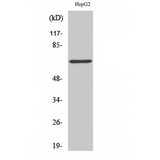 DDX5 Antibody - Western blot of p68 RNA Helicase antibody