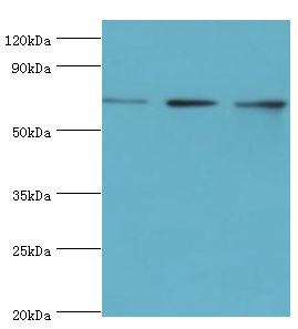 DDX5 Antibody - Western blot. All lanes: Probable ATP-dependent RNA helicase DDX5 antibody at 3 ug/ml. Lane 1: NIH3T3 whole cell lysate. Lane 2: HeLa whole cell lysate. Lane 3: 293T whole cell lysate. secondary Goat polyclonal to rabbit at 1:10000 dilution. Predicted band size: 69 kDa. Observed band size: 69 kDa.