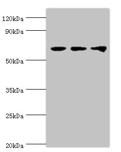 DDX5 Antibody - Western blot All lanes: Probable ATP-dependent RNA helicase DDX5 antibody at 3µg/ml Lane 1: NIH/3T3 whole cell lysate Lane 2: Hela whole cell lysate Lane 3: 293T whole cell lysate Secondary Goat polyclonal to rabbit IgG at 1/10000 dilution Predicted band size: 70, 61 kDa Observed band size: 70 kDa