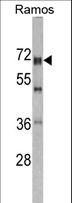 DDX5 Antibody - Western blot of DDX5 antibody in Romas cell line lysates (35 ug/lane). DDX5 (arrow) was detected using the purified antibody.