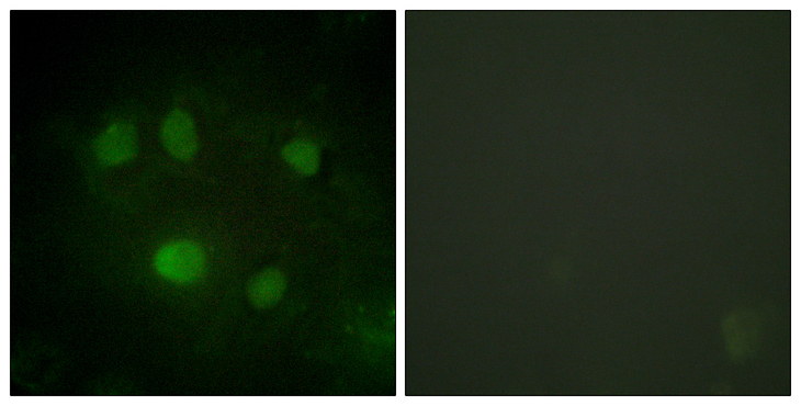 DDX5 Antibody - Immunofluorescence analysis of HeLa cells, using DDX5/DEAD-box Protein 5 Antibody. The picture on the right is blocked with the synthesized peptide.