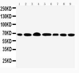 DDX5 Antibody - WB of DDX5 antibody. Lane 1: Rat Testis Tissue Lysate. Lane 2: Mouse Testis Tissue Lysate. Lane 3: HELA Cell Lysate. Lane 4: MCF-7 Cell Lysate. Lane 5: NIH3T3 Cell Lysate. Lane 6: SKOV Cell Lysate. Lane 7: MM231 Cell Lyate.