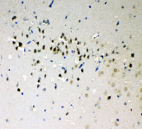 DDX5 Antibody - DDX5 antibody. IHC(P): Rat Brain Tissue.
