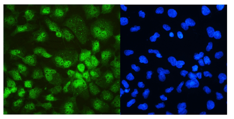 DDX5 Antibody - IF analysis of DDX5 using anti-DDX5 antibody DDX5 was detected in immunocytochemical section of A431 cell. Enzyme antigen retrieval was performed using IHC enzyme antigen retrieval reagent for 15 mins. The tissue section was blocked with 10% goat serum. The tissue section was then incubated with 2µg/mL rabbit anti-DDX5 Antibody overnight at 4°C. DyLight®488 Conjugated Goat Anti-Rabbit IgG was used as secondary antibody at 1:100 dilution and incubated for 30 minutes at 37°C. The section was counterstained with DAPI. Visualize using a fluorescence microscope and filter sets appropriate for the label used.