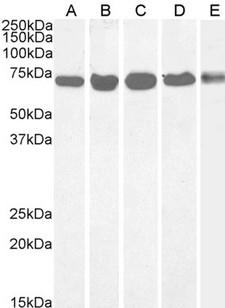 DDX5 Antibody - DDX5 / p68 RNA helicase antibody (0.5µg/ml) staining of cell lines A431(A), HeLa(B), HepG2(C), Jurkat(D) and NIH3T3 (E) lysate (35µg protein in RIPA buffer). Primary incubation was 1 hour. Detected by chemiluminescence.