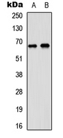 DDX5 Antibody - Western blot analysis of DDX5 expression in A431 (A); SHSY5Y (B) whole cell lysates.