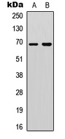 DDX5 Antibody - Western blot analysis of DDX5 (pY593) expression in HeLa (A); A431 (B) whole cell lysates.
