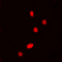 DDX5 Antibody - Immunofluorescent analysis of DDX5 (pY593) staining in HeLa cells. Formalin-fixed cells were permeabilized with 0.1% Triton X-100 in TBS for 5-10 minutes and blocked with 3% BSA-PBS for 30 minutes at room temperature. Cells were probed with the primary antibody in 3% BSA-PBS and incubated overnight at 4 ??C in a humidified chamber. Cells were washed with PBST and incubated with a DyLight 594-conjugated secondary antibody (red) in PBS at room temperature in the dark. DAPI was used to stain the cell nuclei (blue).