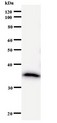DDX5 Antibody - Western blot of immunized recombinant protein using DDX5 antibody.