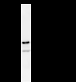 DDX5 Antibody - Immunoprecipitation: RIPA lysate of HeLa cells was incubated with anti-DDX5 mAb. Predicted molecular weight: 69 kDa