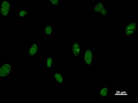 DDX5 Antibody - Immunostaining analysis in HeLa cells. HeLa cells were fixed with 4% paraformaldehyde and permeabilized with 0.1% Triton X-100 in PBS. The cells were immunostained with anti-DDX5 mAb.
