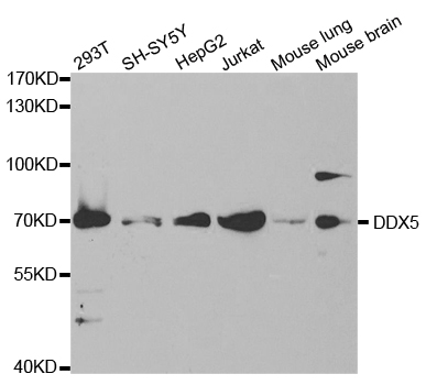 DDX5 Antibody - Western blot analysis of extracts of various cell lines, using DDX5 antibody.