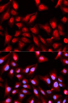 DDX5 Antibody - Immunofluorescence analysis of U20S cell using DDX5 antibody. Blue: DAPI for nuclear staining.