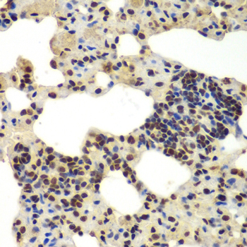 DDX5 Antibody - Immunohistochemistry of paraffin-embedded rat lung tissue.