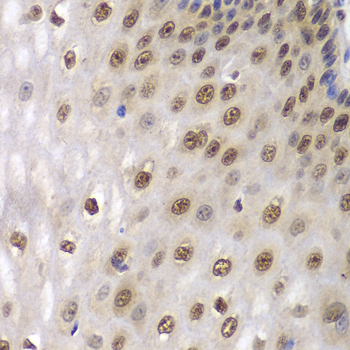 DDX5 Antibody - Immunohistochemistry of paraffin-embedded human esophageal tissue.