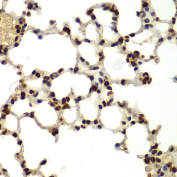 DDX5 Antibody - Immunohistochemistry of paraffin-embedded mouse lung tissue.