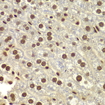 DDX5 Antibody - Immunohistochemistry of paraffin-embedded mouse liver tissue.