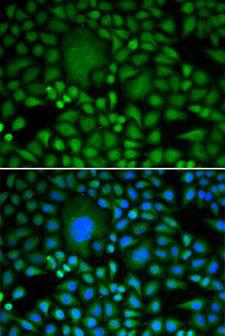 DDX5 Antibody - Immunofluorescence analysis of HeLa cells using DDX5 antibody. Blue: DAPI for nuclear staining.