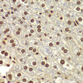 DDX5 Antibody - Immunohistochemistry of paraffin-embedded mouse liver using DDX5 antibody at dilution of 1:100 (40x lens).