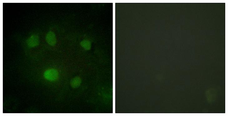 DDX5 Antibody - Peptide - + Immunofluorescence analysis of HeLa cells, using DDX5/DEAD-box Protein 5 antibody.