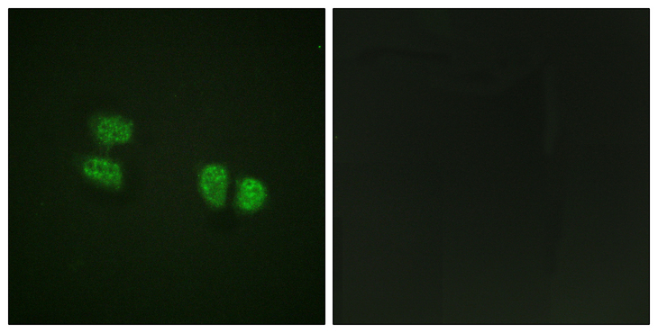DDX5 Antibody - Immunofluorescence analysis of HeLa cells, using DDX5/DEAD-box Protein 5 (Phospho-Tyr593) Antibody. The picture on the right is blocked with the phospho peptide.